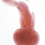 Female Echinorhynchus lageniformis.