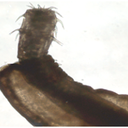 Anterior end of Rhadinorhynchus acanthocephalan.