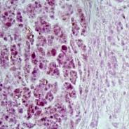 Tissue section showing mycobacterium lesion in sculpin.