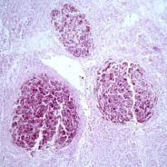 Tissue section showing mycobacterium lesion in sculpin.