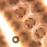 Copepod egg sack.