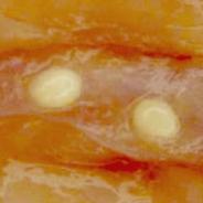 Fish muscle showing numerous white cysts of Henneguya salminicola.