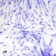 RTG-2 cells inoculated with IPNV