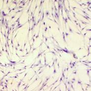 RTG-2 cells inoculated with IPNV