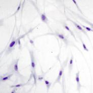 RTG-2 cells inoculated with IPNV