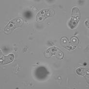 Ceratomyxa shasta myxospores.