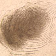 Myxobolus squamalis cyst beneath scale.