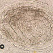Myxobolus squamalis cyst under fish scale.