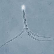 Typical triactinomyxon-type actinospore.