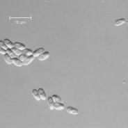 Microsporidian spores.