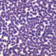 Normal fish blood smear, stained with Diff-Quik.