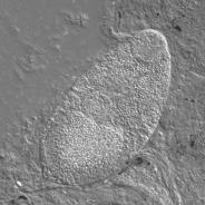 Trematode from kidney of coho salmon.