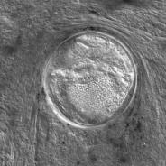 Trematode metacercaria from coho kidney.