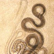 Adult Capillaria nematode, filled with eggs.