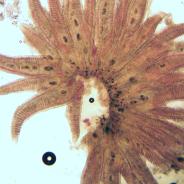 Trematode metacercaria in gills.