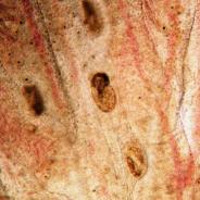 Trematode metacercaria in gills.