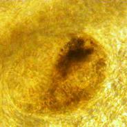 Trematode metacercarium in gills.