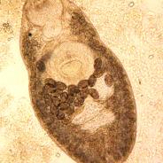 Adult trematode from gall bladder.