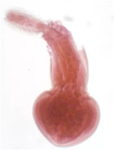 Female Echinorhynchus lageniformis.