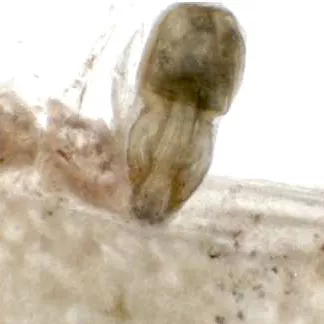 Female Echinorhynchus lageniformis.
