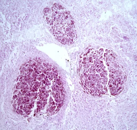 Tissue section showing mycobacterium lesion in sculpin.