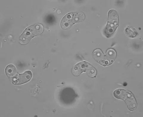 Ceratomyxa shasta myxospores.