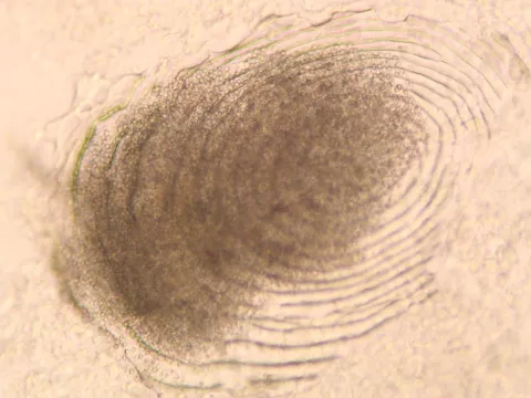 Myxobolus squamalis cyst beneath scale.