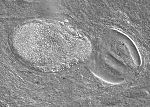 Adult trematode ruptured out of metacercaria.