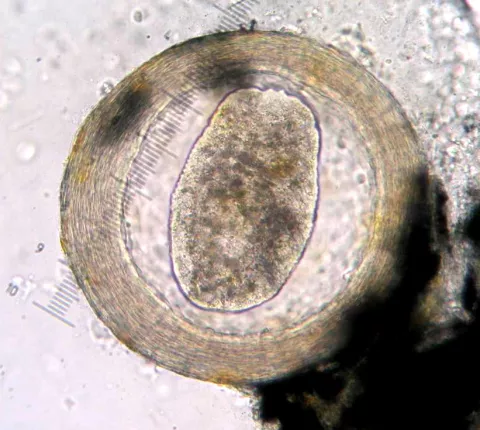 Immature Neascus.