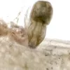 Female Echinorhynchus lageniformis.