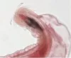 Proboscis of female Neoechinorhynchus sp.