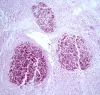 Tissue section showing mycobacterium lesion in sculpin.
